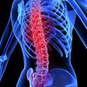 Spinal cord nervous tissue damage
